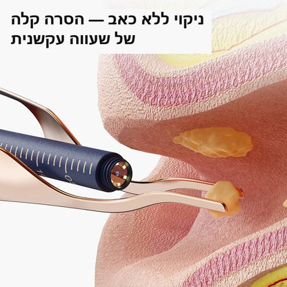 ZIVLO EarVision - ניקוי ללא כאב